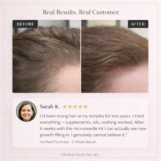 Cazoba™ PCOS Hair Regrowth System