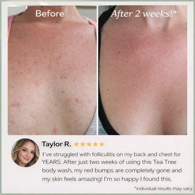 Clear Bacne Body Cleanser