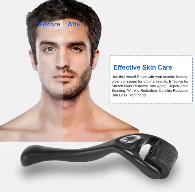 Follicle Derma Roller