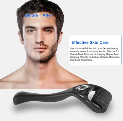 Follicle Derma Roller