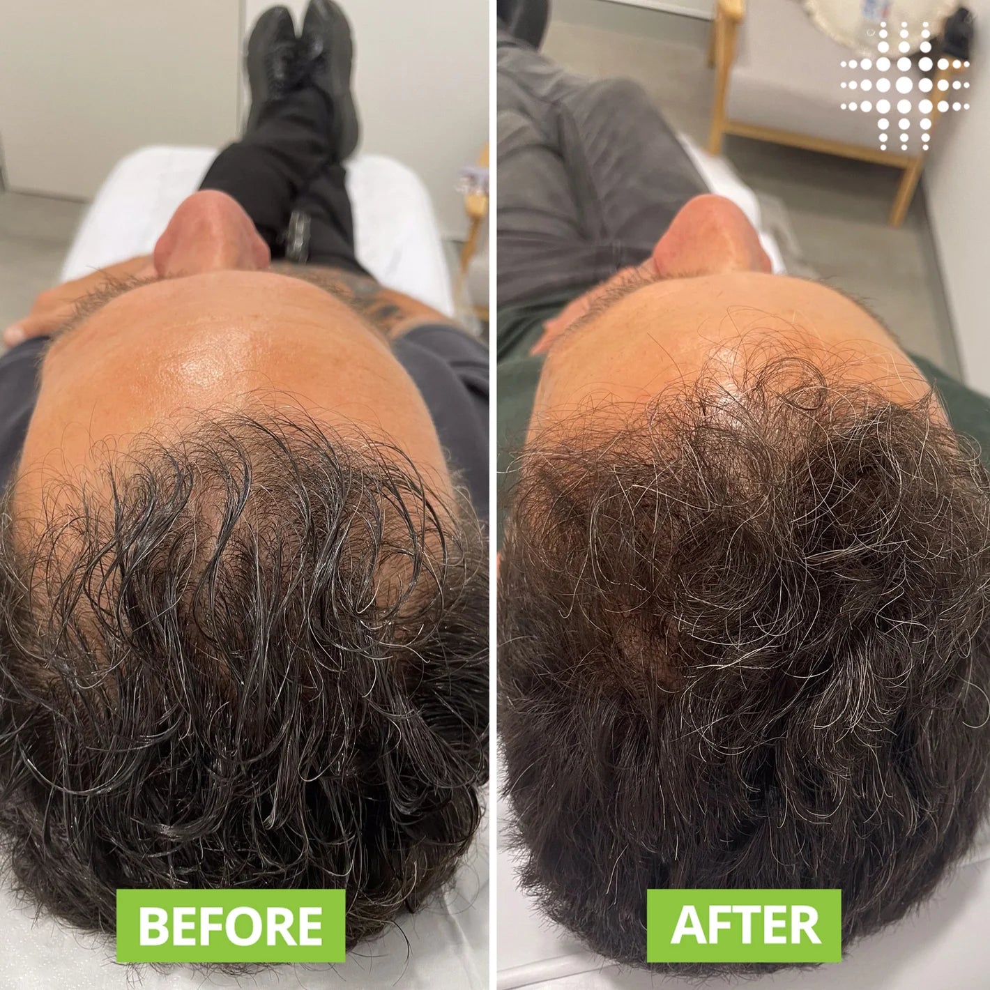 Cazoba Hair Growth Serum Roll