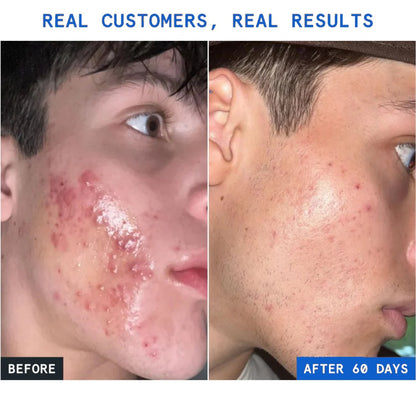 GHK-Cu Peptides Serum
