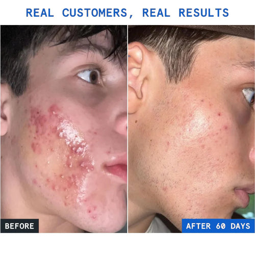 GHK-Cu Peptides Serum
