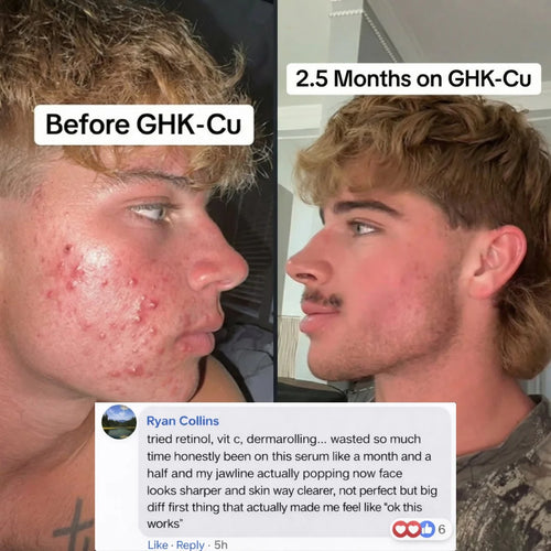 GHK-Cu Peptides Serum