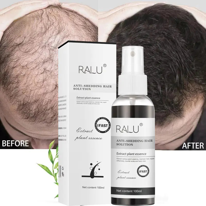 Herbal Hair Growth Spray