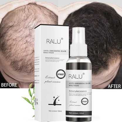 Herbal Hair Growth Spray
