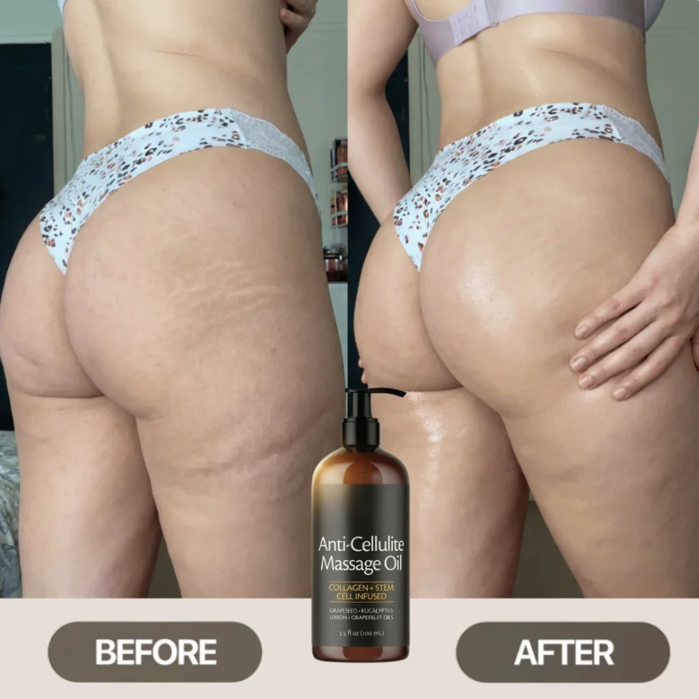 Anti-Cellulite Massage Oil