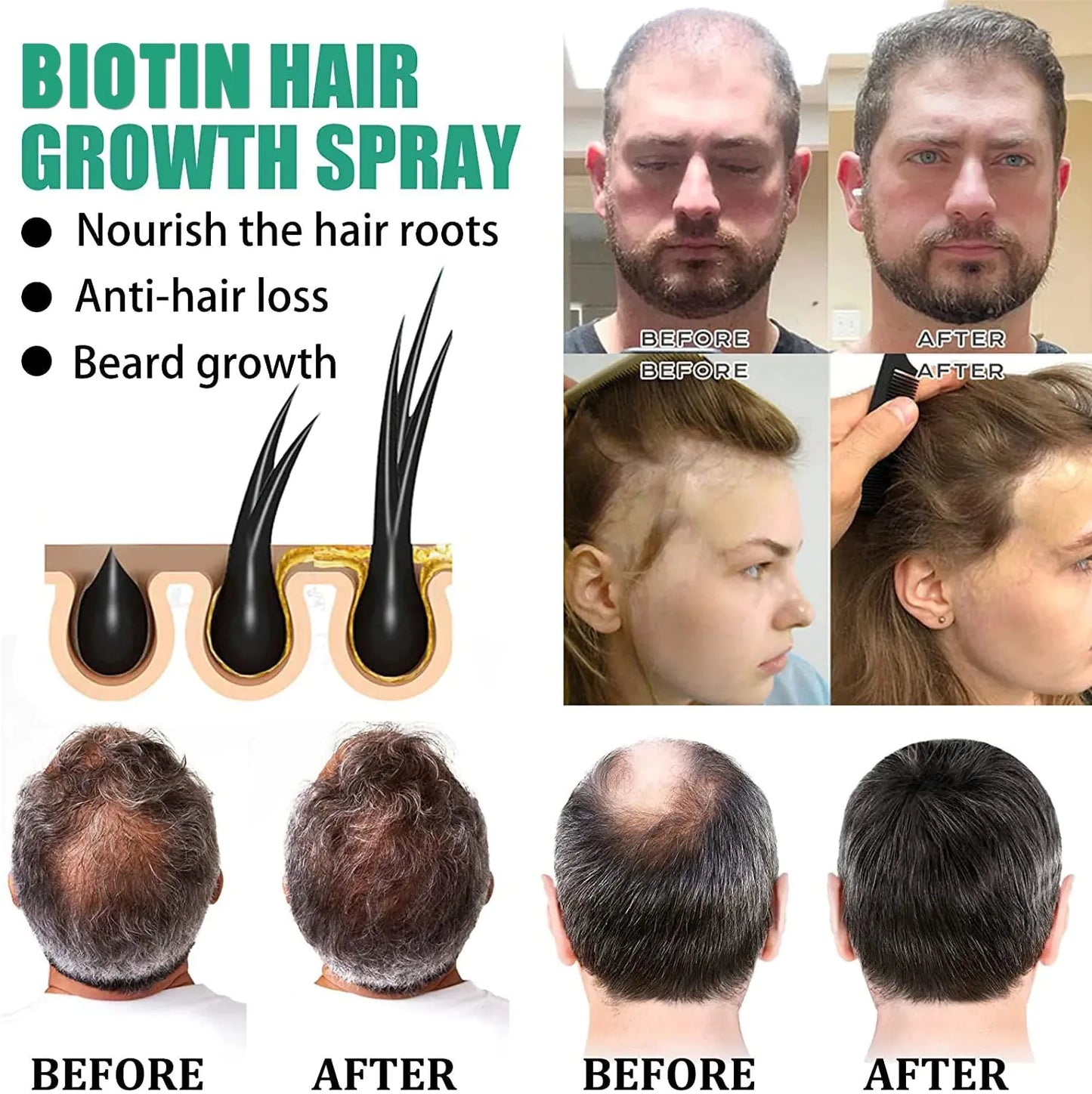 Herbal Hair Growth Spray