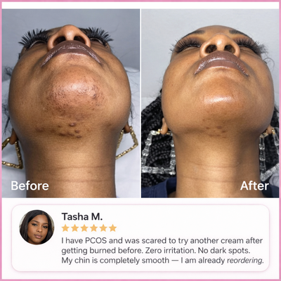 Hair Removal Trilogy Kit