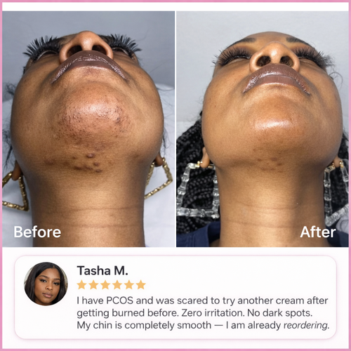 Hair Removal Trilogy Kit