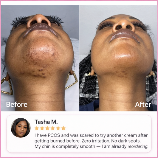 Hair Removal Trilogy Kit